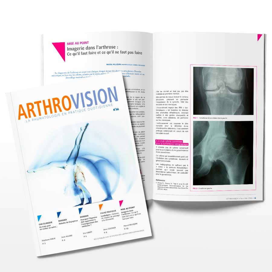 Arthrovision